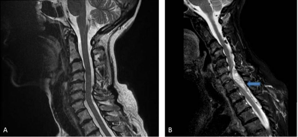 EEL6871 in Medical Fields